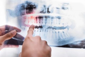 3D Dental Tomography