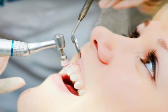 Tooth Cleaning - Medworld Clinic