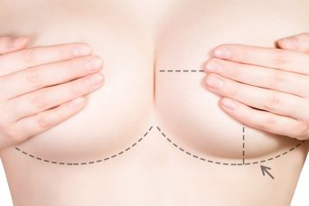 Breast Reduction recovery process
