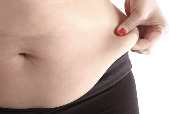 Абдоминопластика - Tummy Tuck