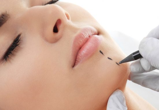 chin surgery / sliding genioplasty surgery procedure in Turkey