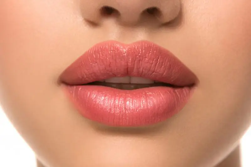 Lip Filler