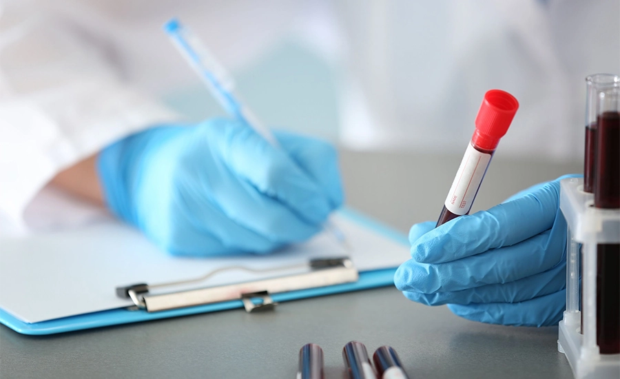 Aging Parameters in Blood, Blood Analysis