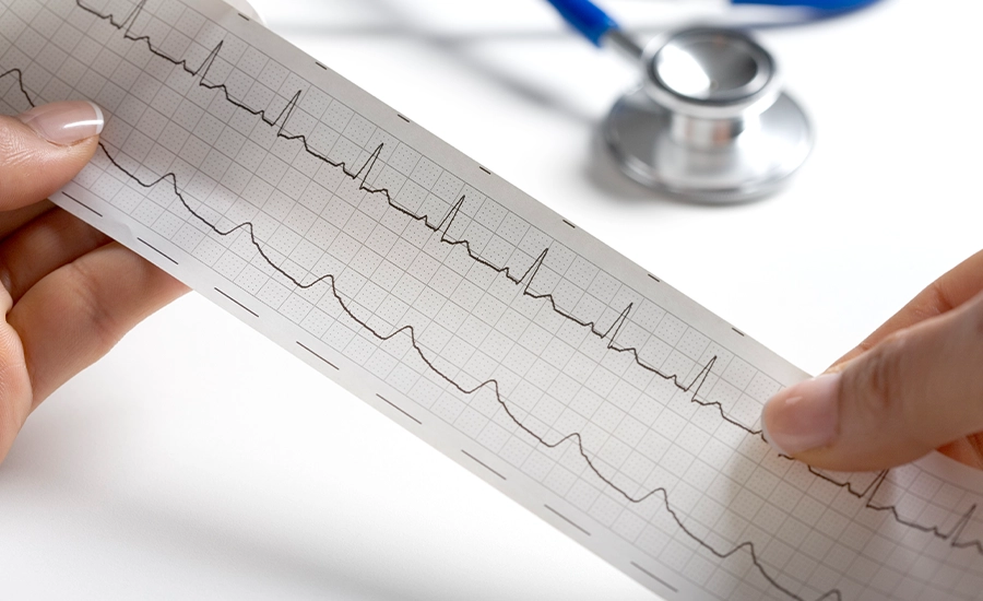 Electrocardiogram, ECG