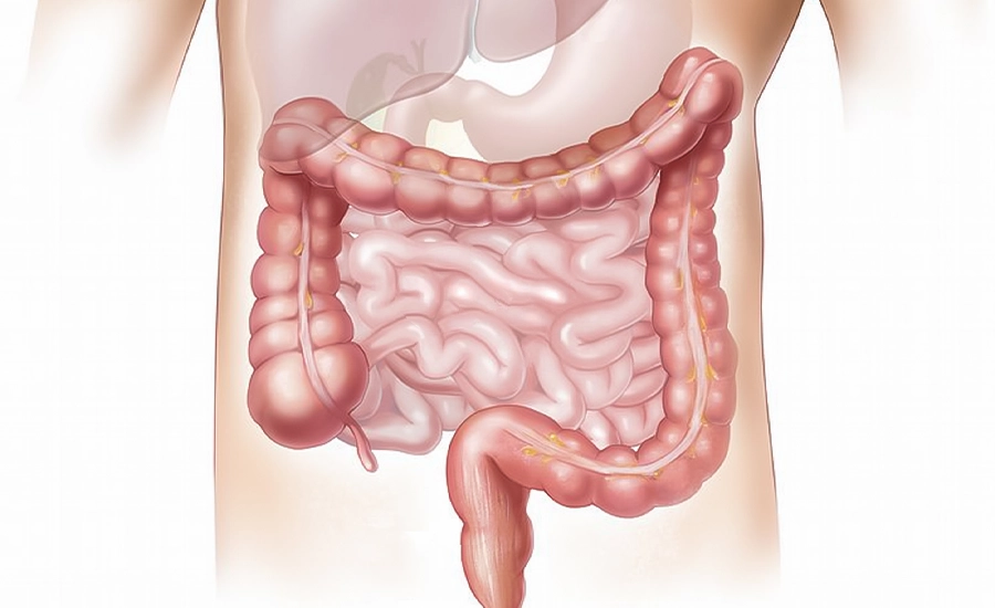 Colon Therapy, Health in Antalya, Medworld Clinic, Individual bowel cleansing