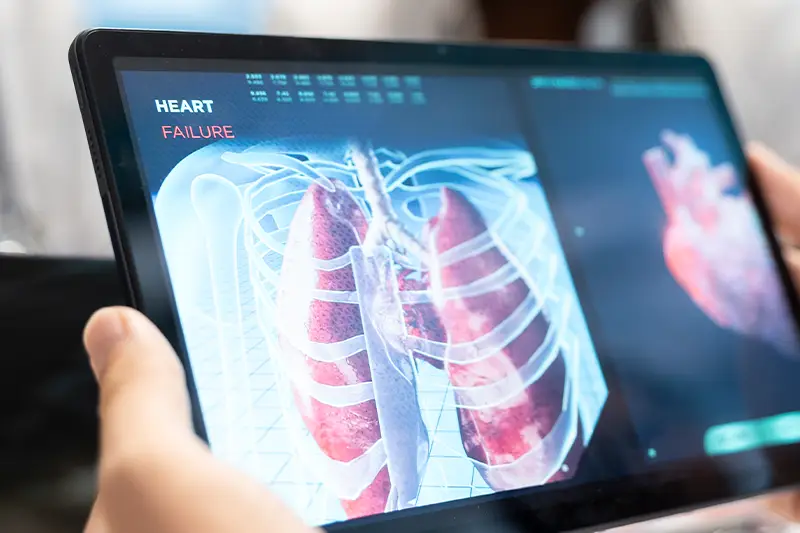 Pulmonary-Rehabilitation-1