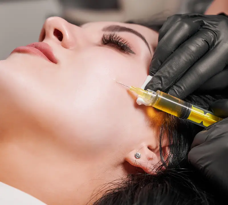 PRP Treatment