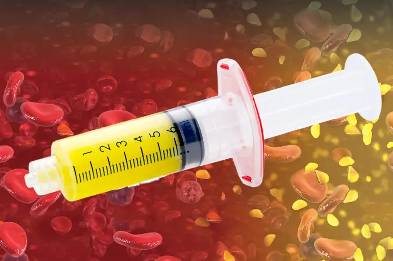 Autologous Conditioned Plasma (ACP) Therapy