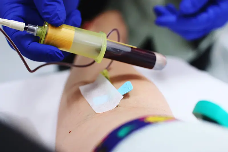 Autologous Conditioned Plasma (ACP) Therapy