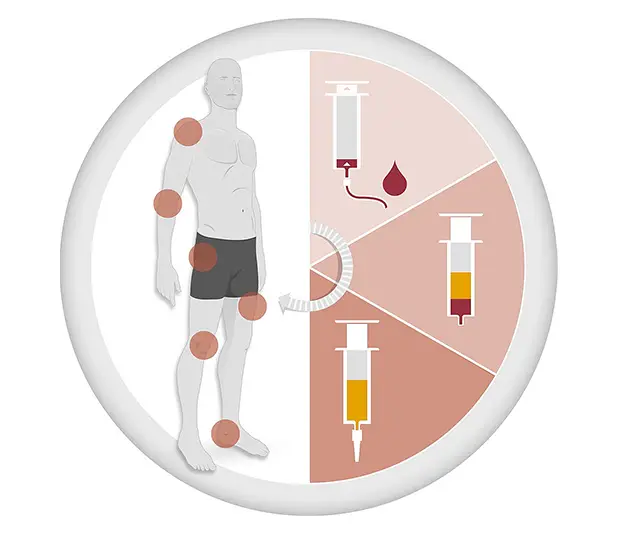 Autologous Conditioned Plasma (ACP) Therapy