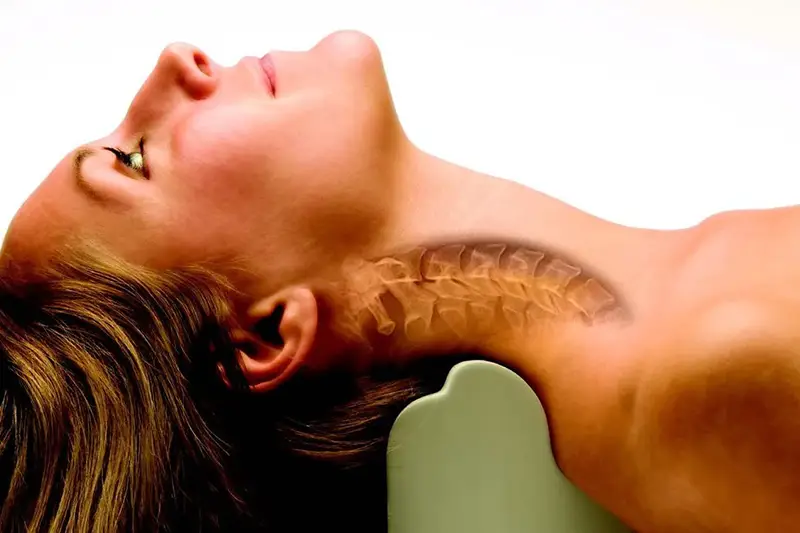Cervical Lordosis Loss (Neck Straightening)