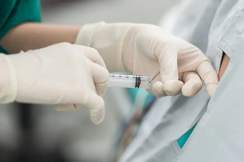 Epidural Injection