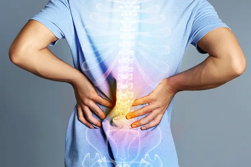 Lumbar Disc Herniation