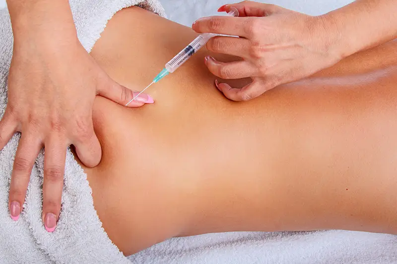 Piriformis Injection