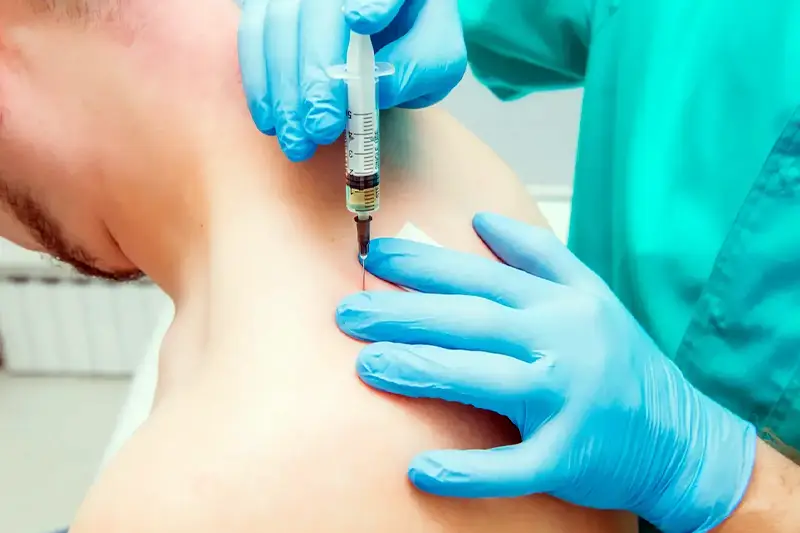 Trigger Point Injections